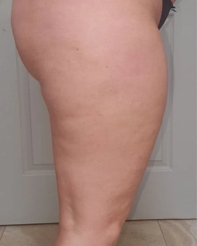 Na